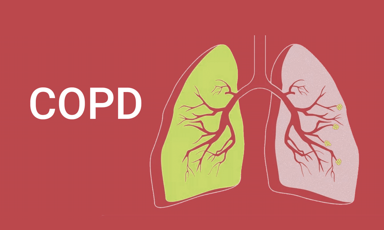 Copd meaning